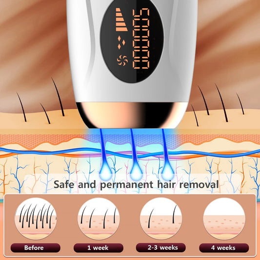 Portabler IPL Laser Epilator 999999 Blitzen - schmerzlos, Permanent Haarentferner - HIMMLICH.DE