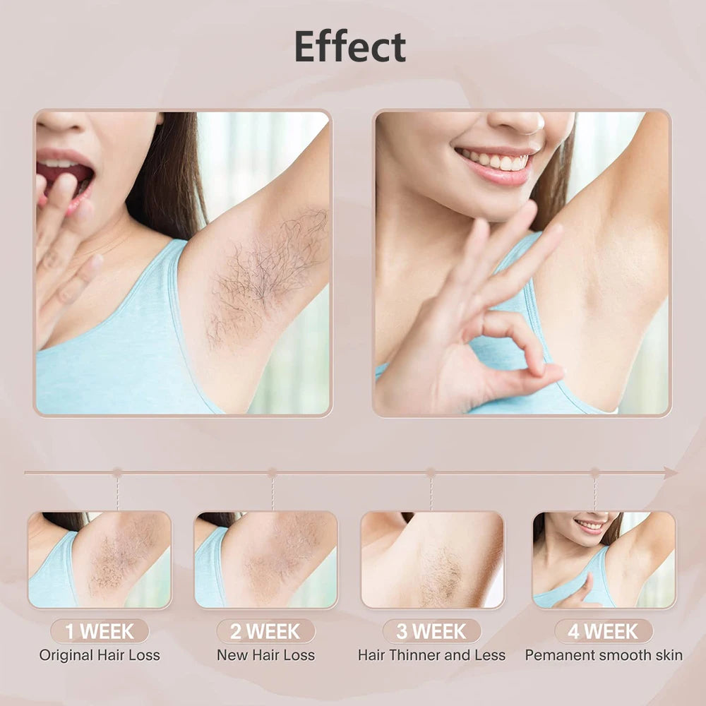 Portabler IPL Laser Epilator 999999 Blitzen - schmerzlos, Permanent Haarentferner - HIMMLICH.DE